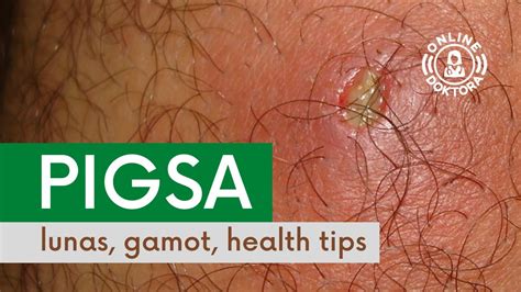 PIGSA: Lunas, Gamot at Health Tips .